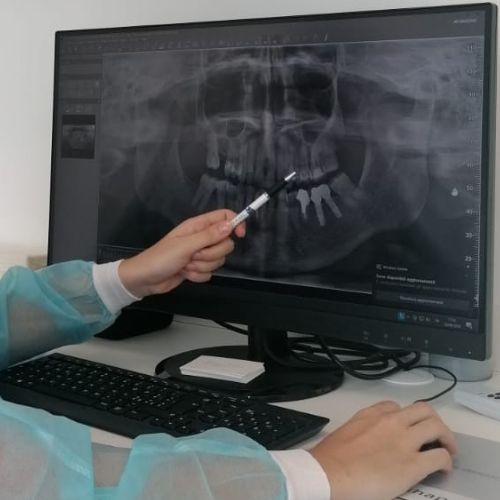 radiografia della bocca su monitor per valutazione della parodontopatia e piano di cura